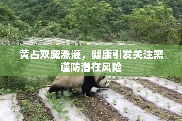 黄占双腿涨灌，健康引发关注需谨防潜在风险
