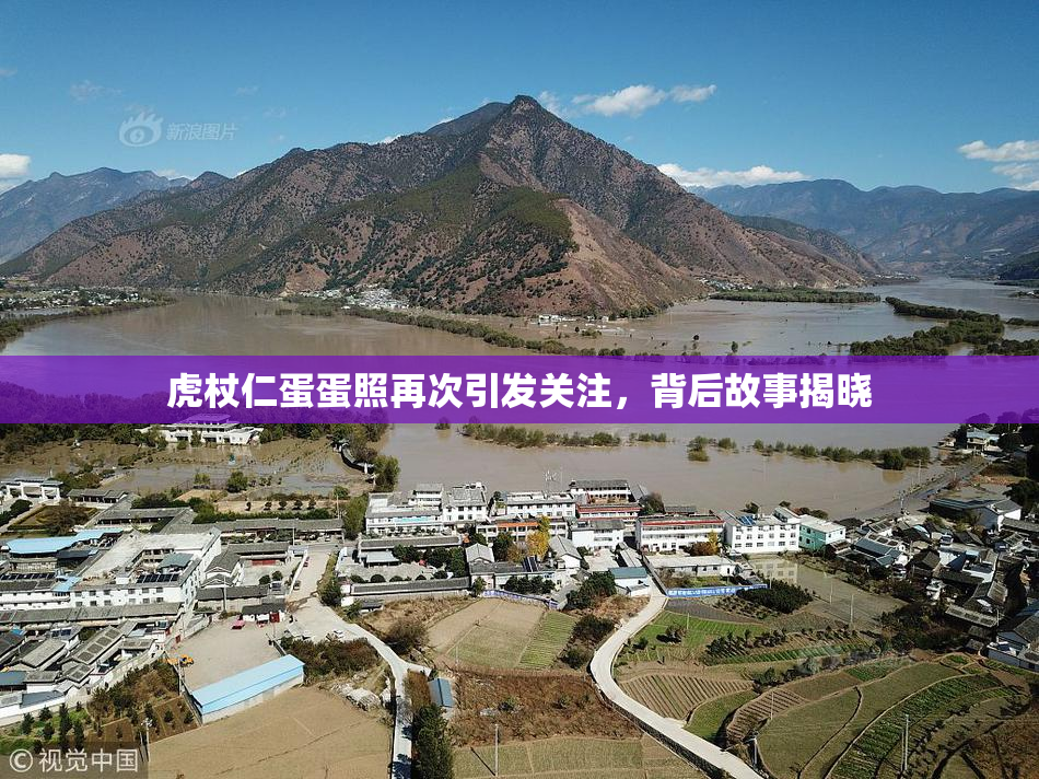 虎杖仁蛋蛋照再次引发关注，背后故事揭晓