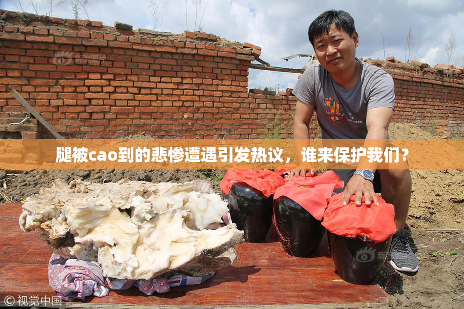 腿被cao到的悲惨遭遇引发热议，谁来保护我们？