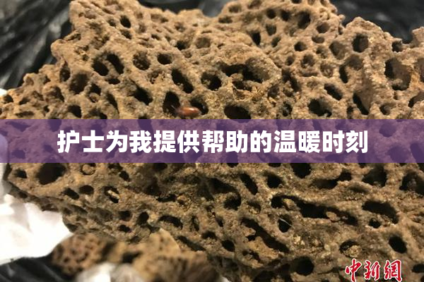 护士为我提供帮助的温暖时刻