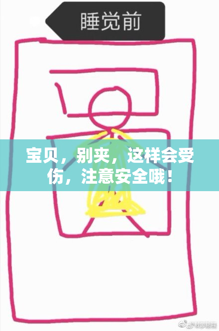 宝贝，别夹，这样会受伤，注意安全哦！