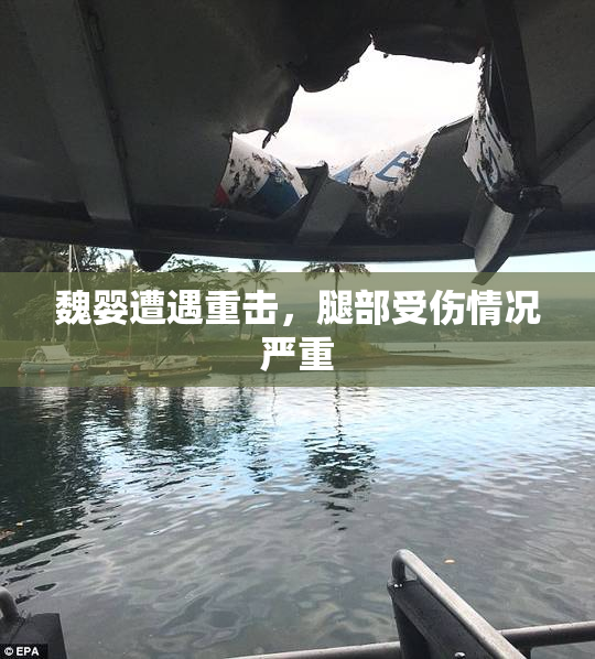 魏婴遭遇重击，腿部受伤情况严重