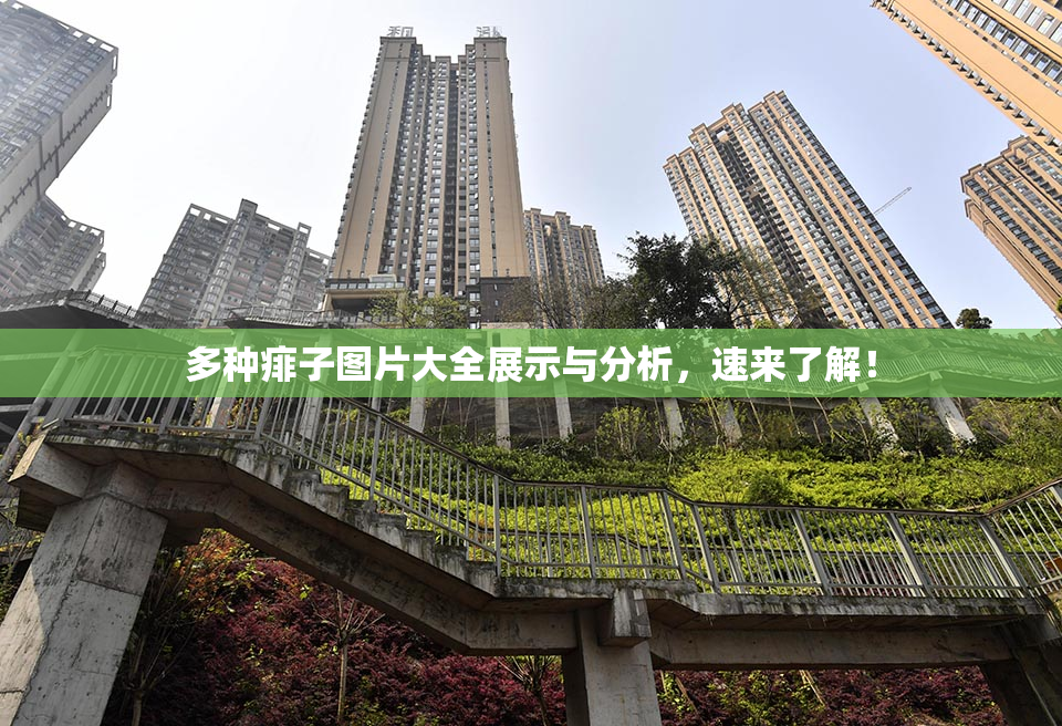 多种痱子图片大全展示与分析，速来了解！