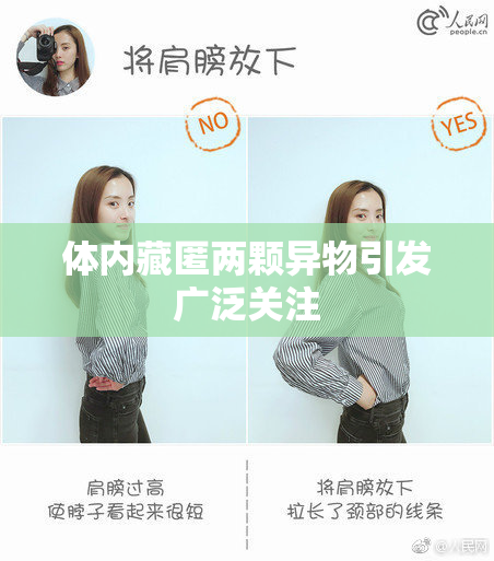 体内藏匿两颗异物引发广泛关注