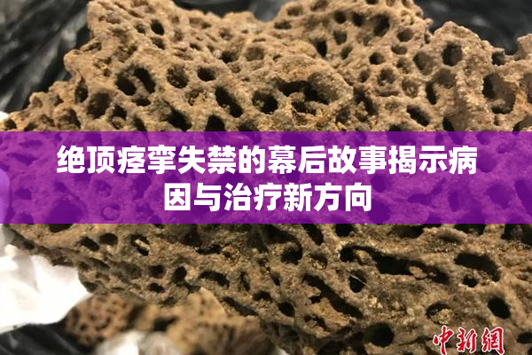 绝顶痉挛失禁的幕后故事揭示病因与治疗新方向