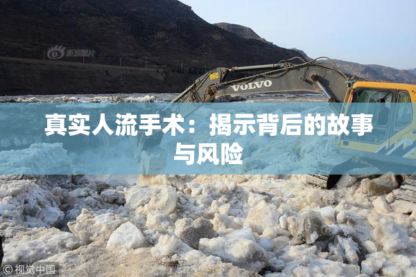 真实人流手术：揭示背后的故事与风险