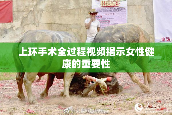 上环手术全过程视频揭示女性健康的重要性