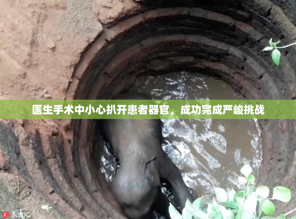 医生手术中小心扒开患者器官，成功完成严峻挑战