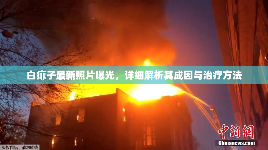 白痱子最新照片曝光，详细解析其成因与治疗方法
