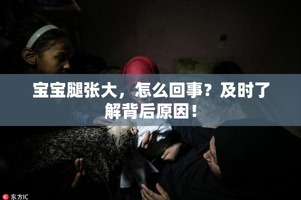 宝宝腿张大，怎么回事？及时了解背后原因！