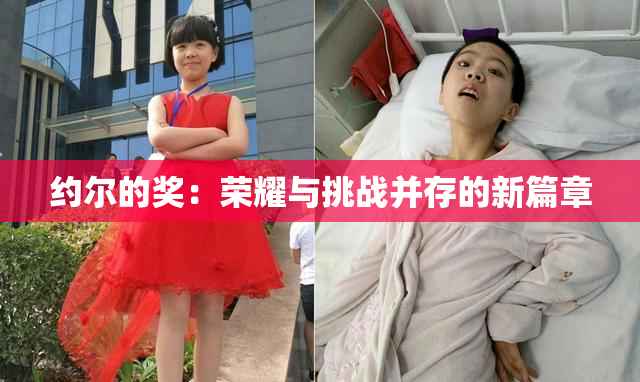 约尔的奖：荣耀与挑战并存的新篇章