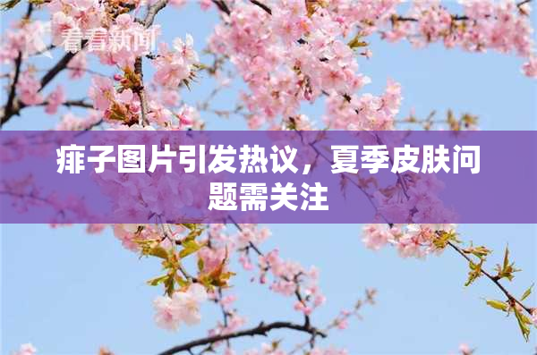 痱子图片引发热议，夏季皮肤问题需关注